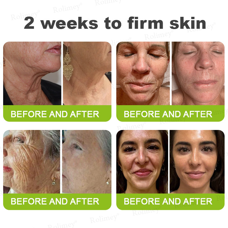 🇿🇦Made and shipped from South Africa 💥Rolimey® Botox & Vita-A Retinol Shot Wrinkle-Lift Tightening cream - Last Day Promotion 70% OFF