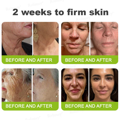 🇿🇦Made and shipped from South Africa 💥Rolimey® Botox & Vita-A Retinol Shot Wrinkle-Lift Tightening cream - Last Day Promotion 70% OFF