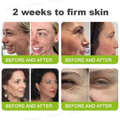 🇿🇦Made and shipped from South Africa 💥Rolimey® Botox & Vita-A Retinol Shot Wrinkle-Lift Tightening cream - Last Day Promotion 70% OFF