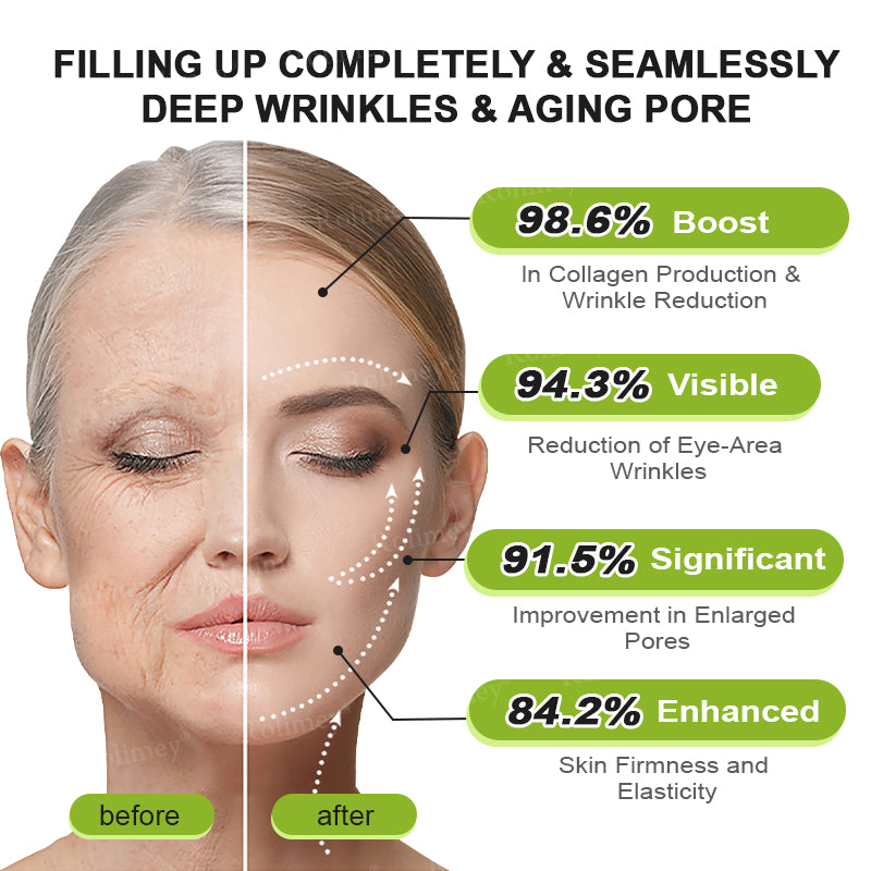 🇿🇦Made and shipped from South Africa 💥Rolimey® Botox & Vita-A Retinol Shot Wrinkle-Lift Tightening cream - Last Day Promotion 70% OFF
