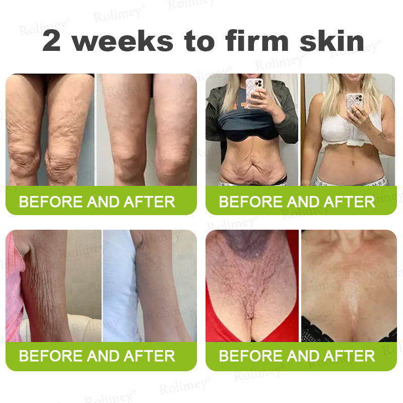 👨‍⚕️💛Made and shipped from South Africa💫Rolimey® Botox & Vita-A Retinol Shot Wrinkle-Lift Tightening cream - Last Day Promotion 70% OFF