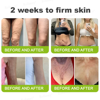 🇿🇦Made and shipped from South Africa 💥Rolimey® Botox & Vita-A Retinol Shot Wrinkle-Lift Tightening cream - Last Day Promotion 70% OFF